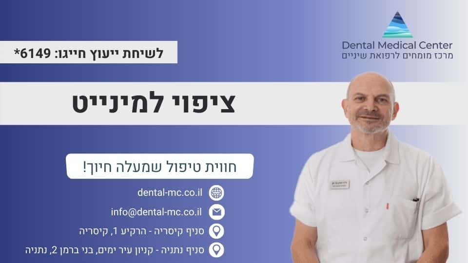 ציפוי למינייט